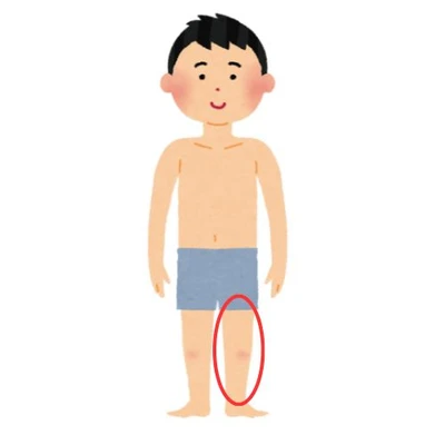 leg
